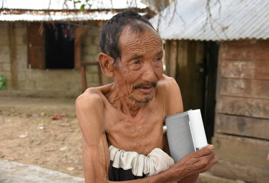 Homme mal-nourrie avec Tuberculose (Biman, 31.3.22)